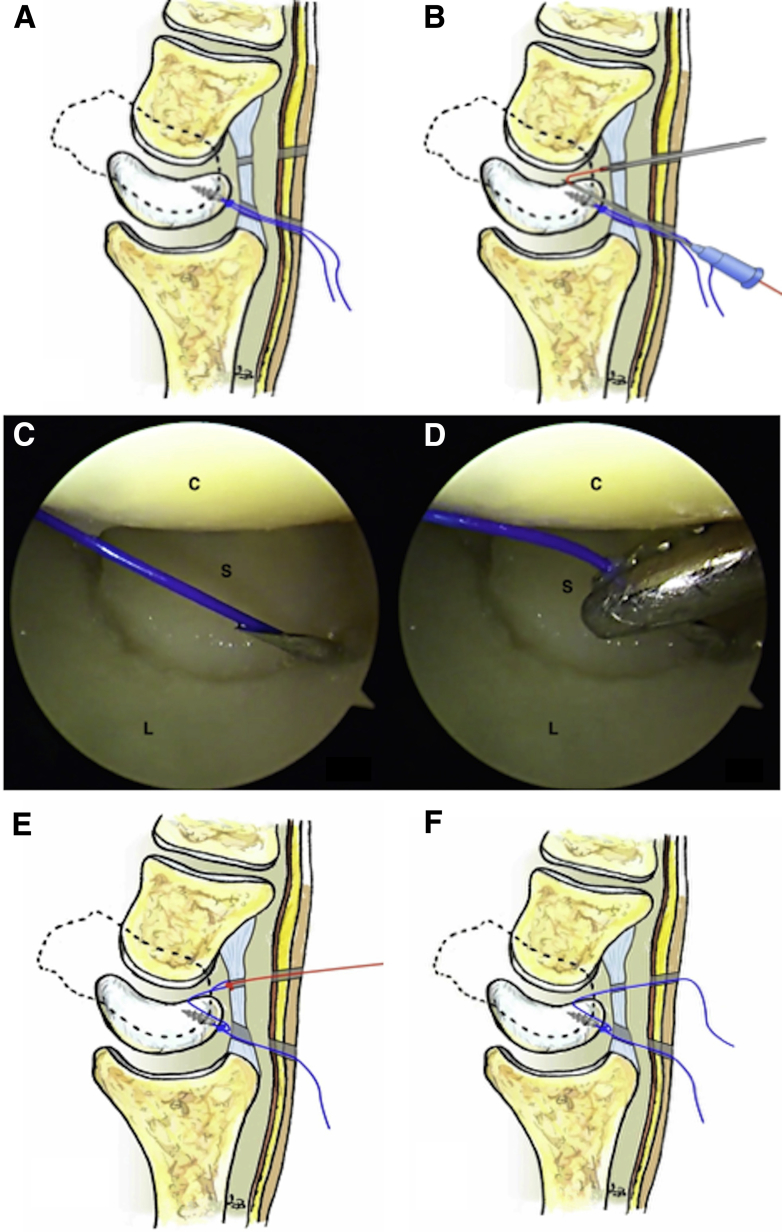 Fig 6