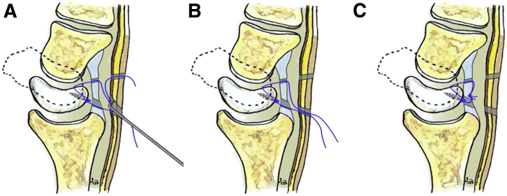 Fig 7