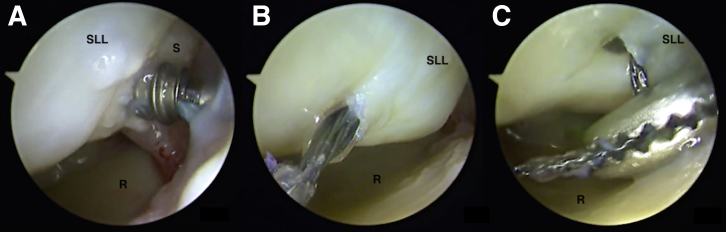 Fig 4