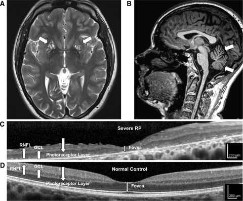 Fig. 1