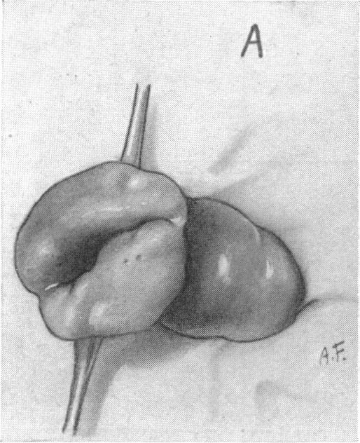 FIG. 10. A