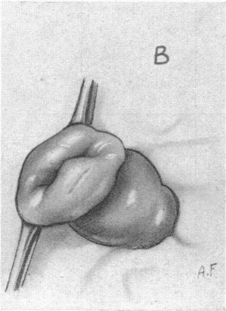 FIG. 10. B