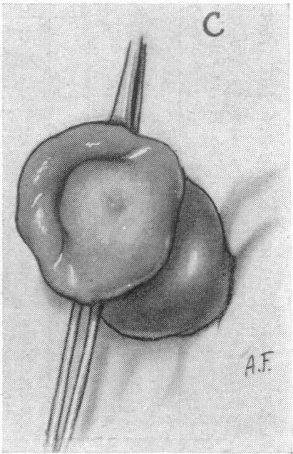 FIG. 10. C