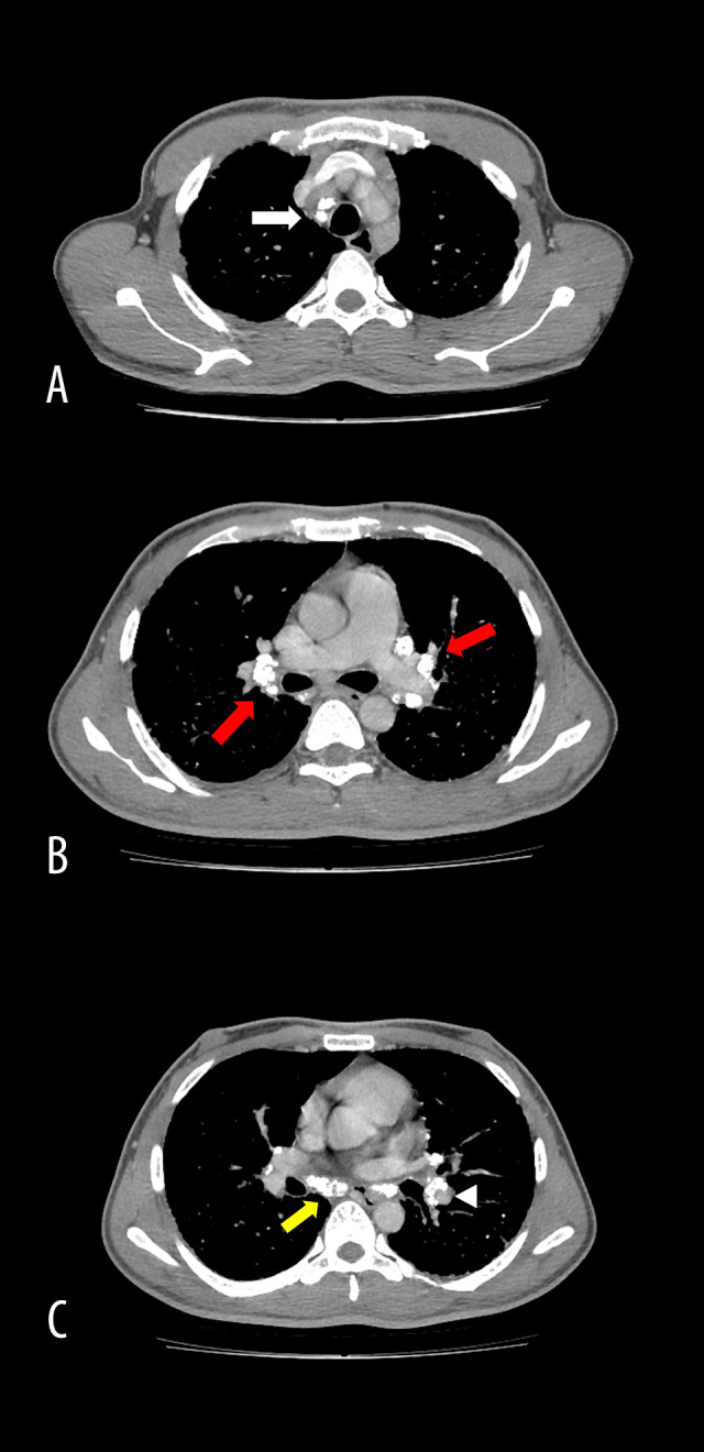 Figure 6.