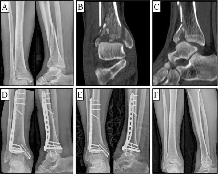 Fig. 6