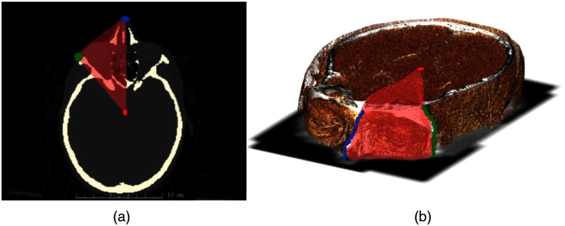 Fig. 5