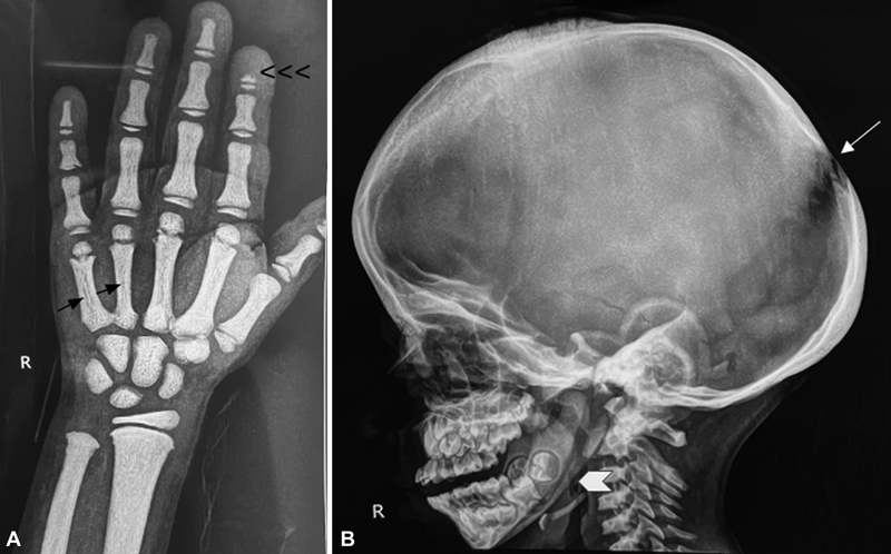 Fig. 17