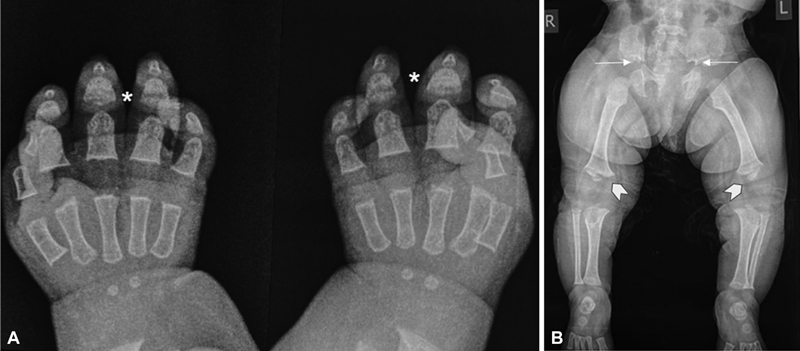 Fig. 14