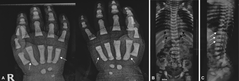 Fig. 16