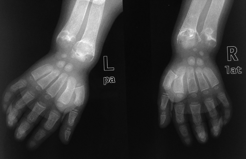 Fig. 18