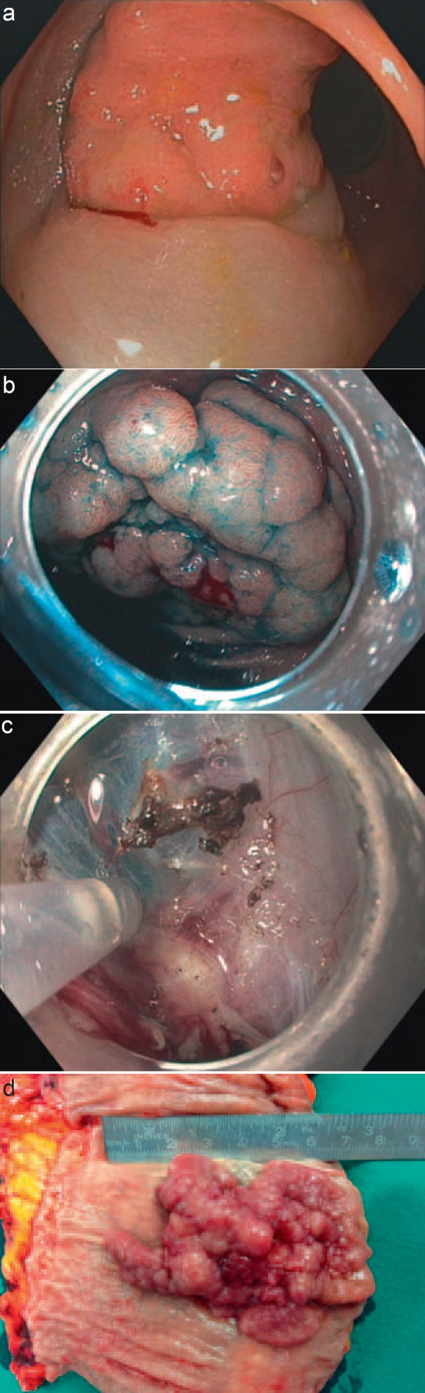 Fig. 1