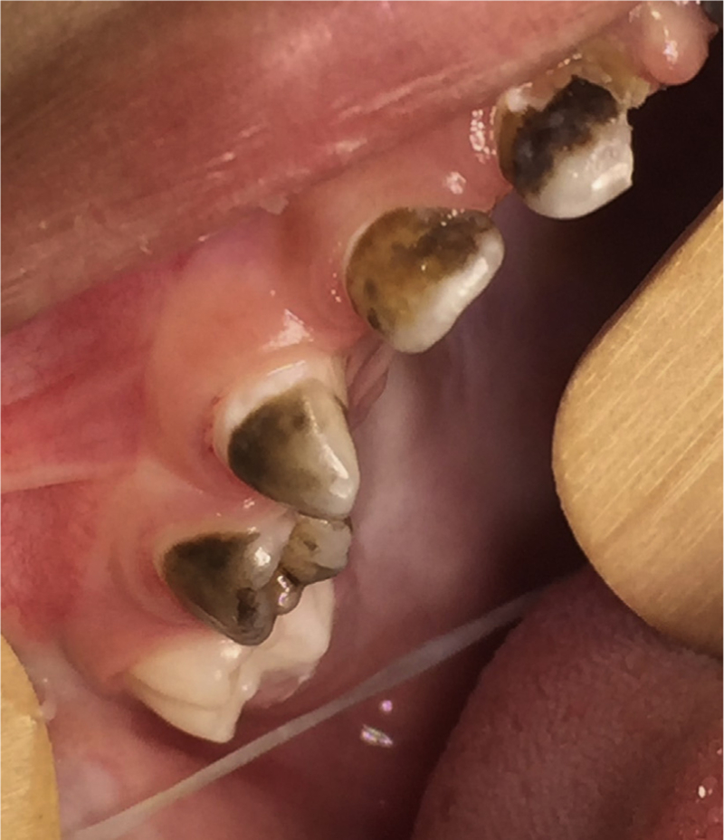 Fig. 4.