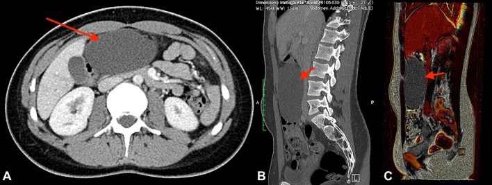 Fig. 1