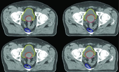 FIG. 7.