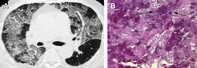 Fig. 4