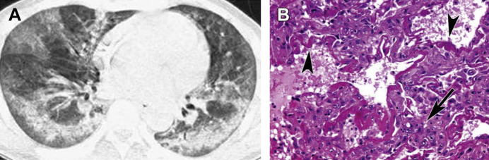 Fig. 1