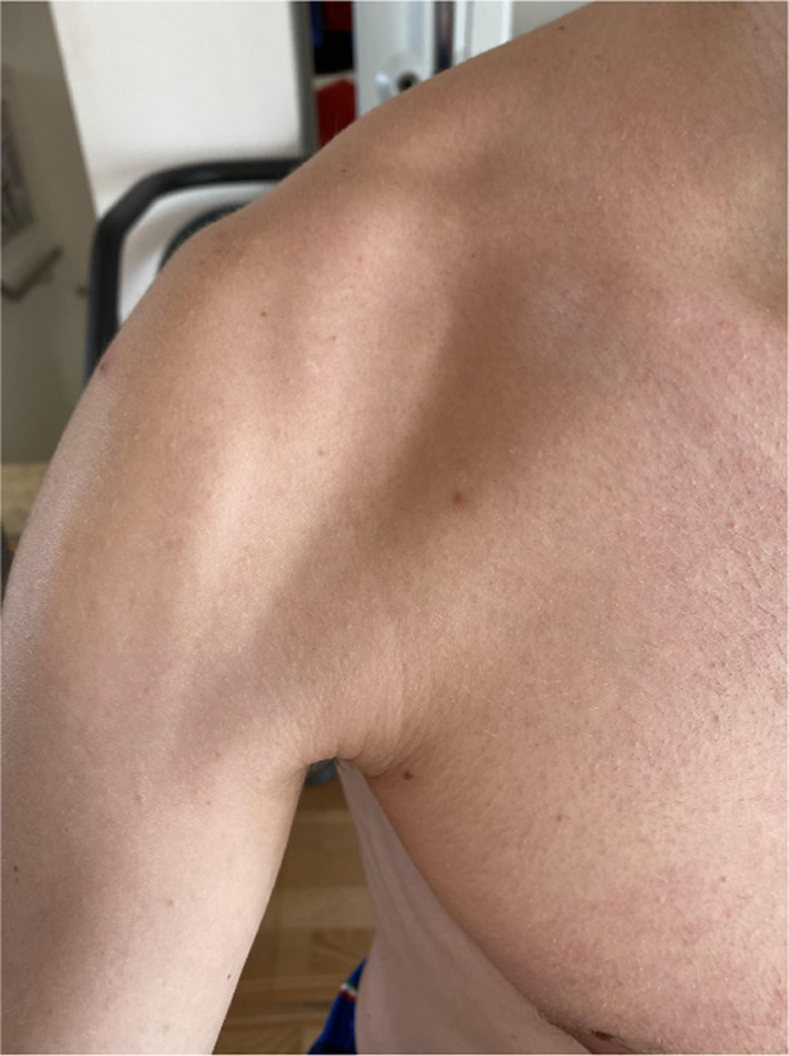 Fig. 6
