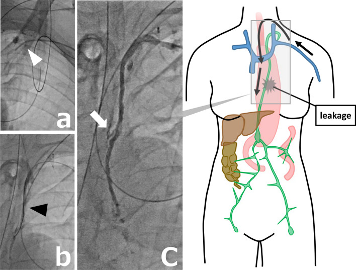 Fig. 2