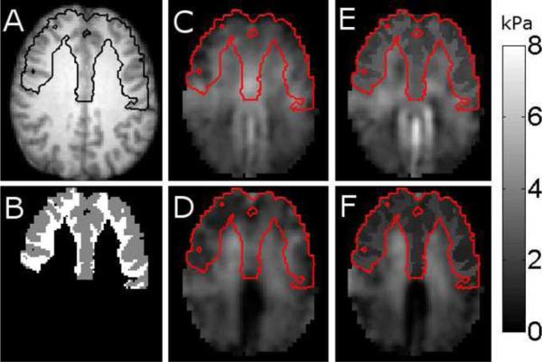 Fig. 10