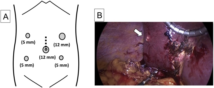 Fig. 4