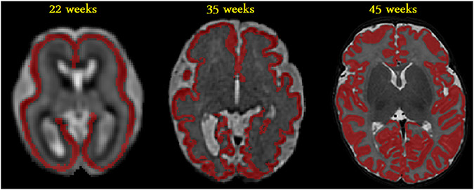 Fig. 5.