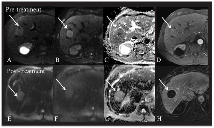 Fig. 14