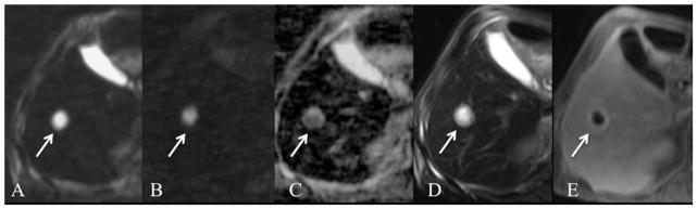 Fig. 12