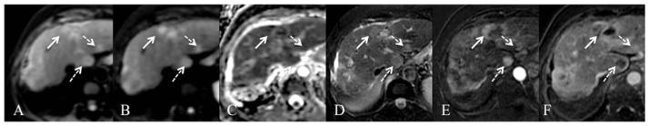 Fig. 15