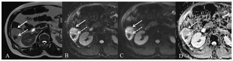 Fig. 11