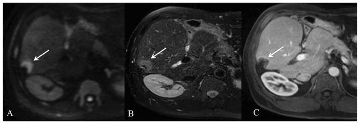 Fig. 13