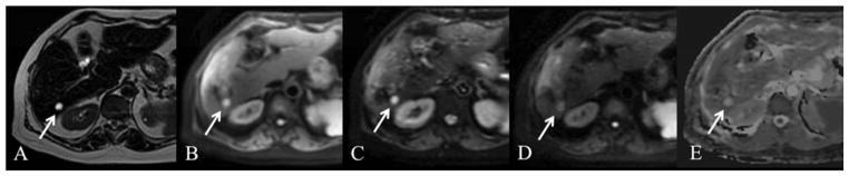 Fig. 10