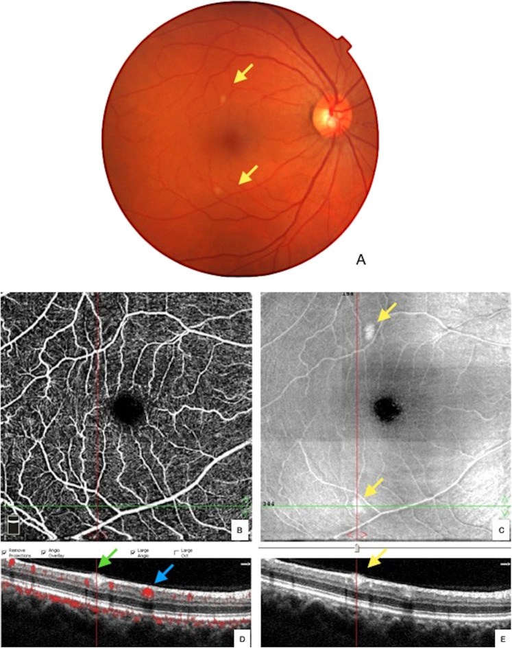 Fig. 2