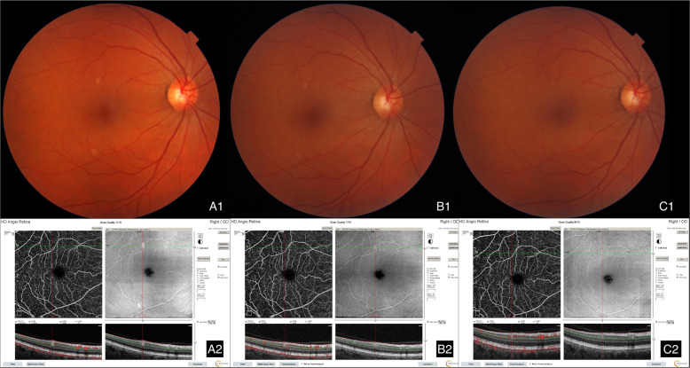 Fig. 3