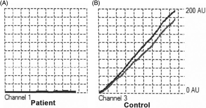 FIGURE 3