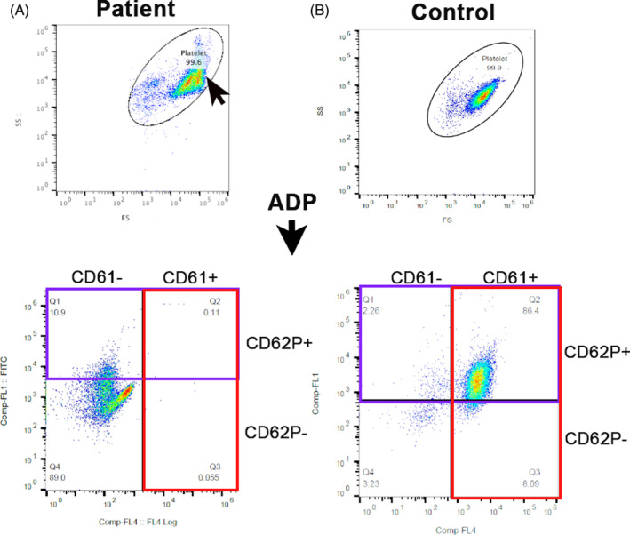 FIGURE 4