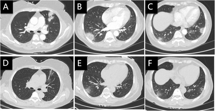 Fig. 5