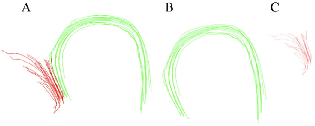 Fig. 12