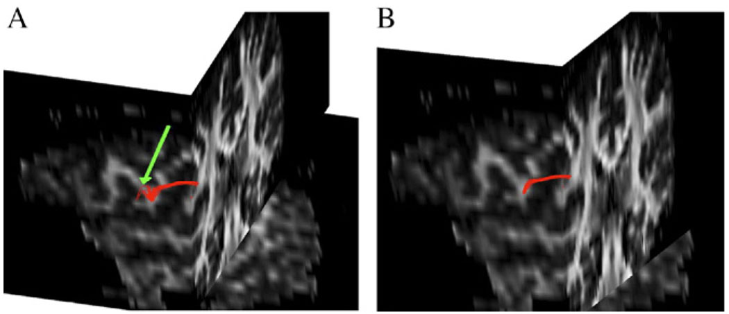 Fig. 11