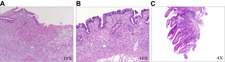 Fig E6