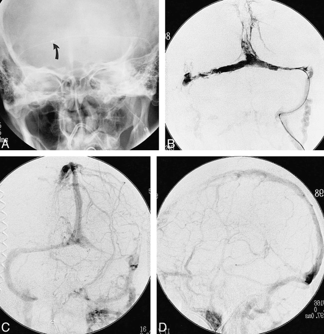 fig 1.