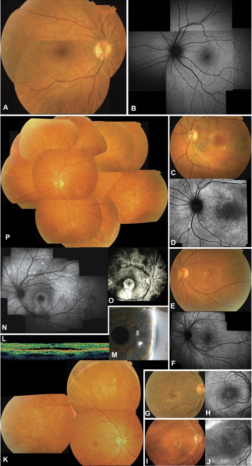 Figure 2