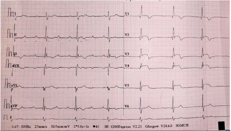 Fig. 2