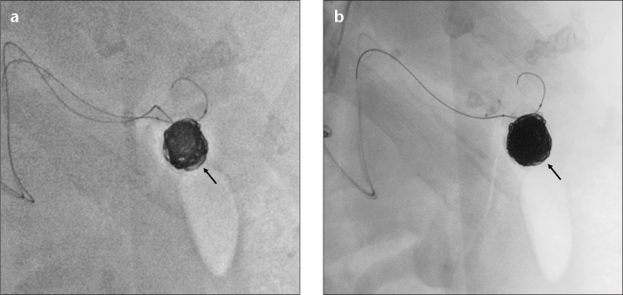 Figure 4. a, b.