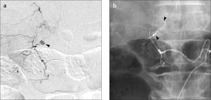 Figure 2. a, b.