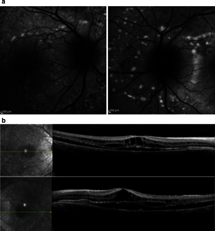 Fig. 2