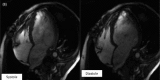 Figure 1b