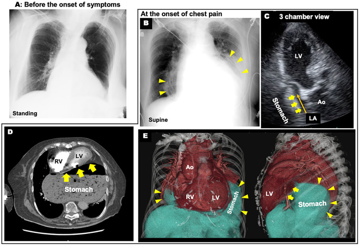 Figure 2.