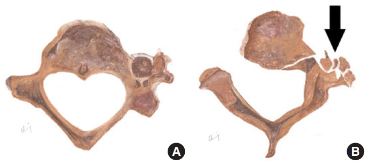 Fig. 13.