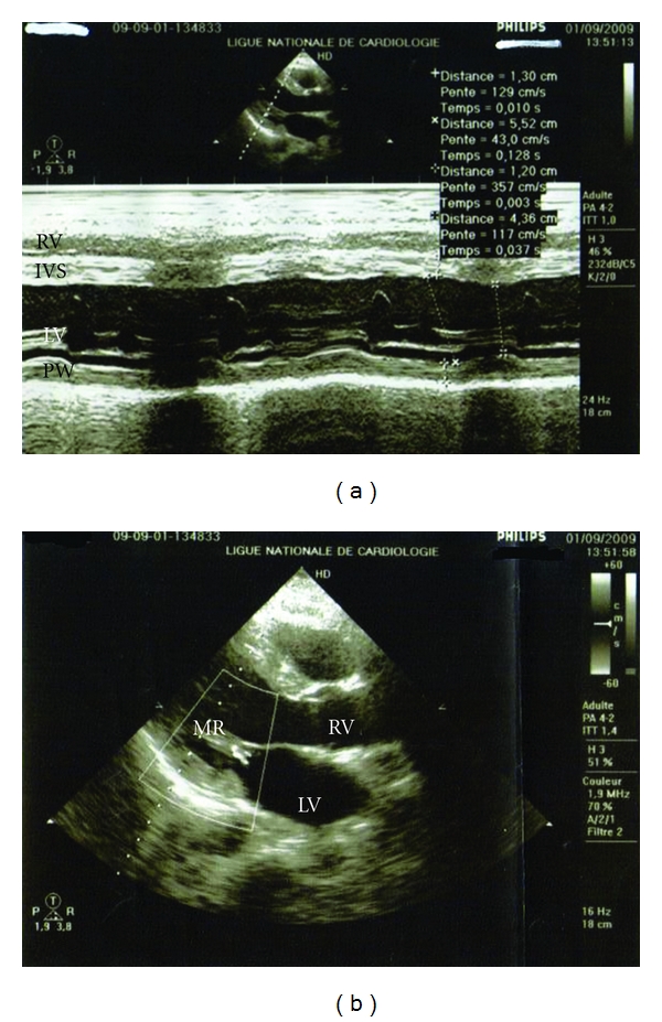 Figure 2