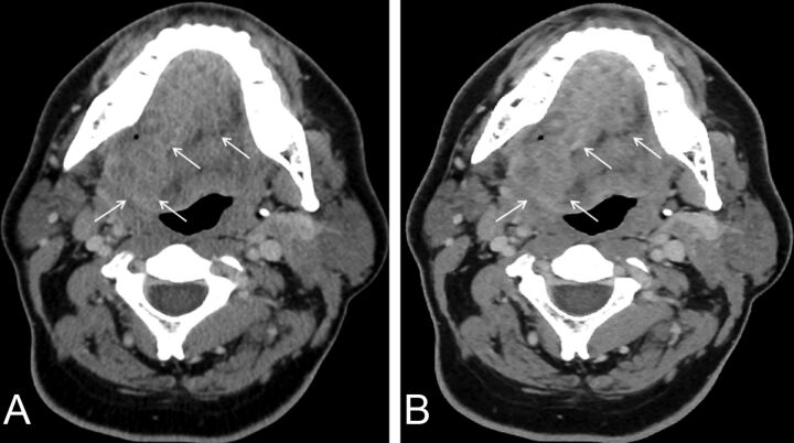 Fig 2.